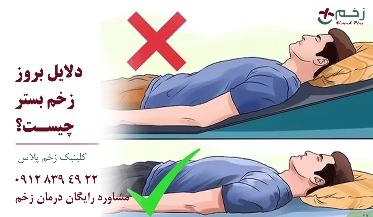 علل زخم بستر