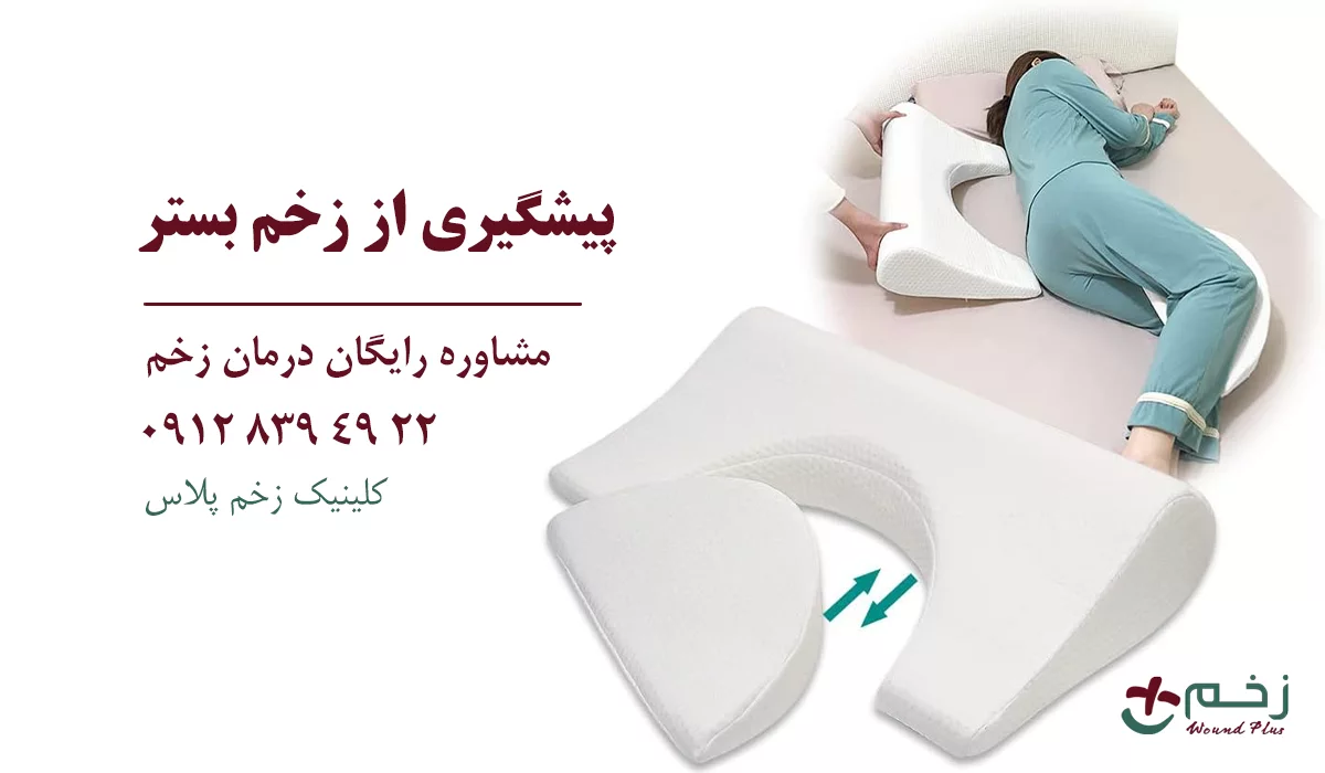 پیشگیری از زخم بستر