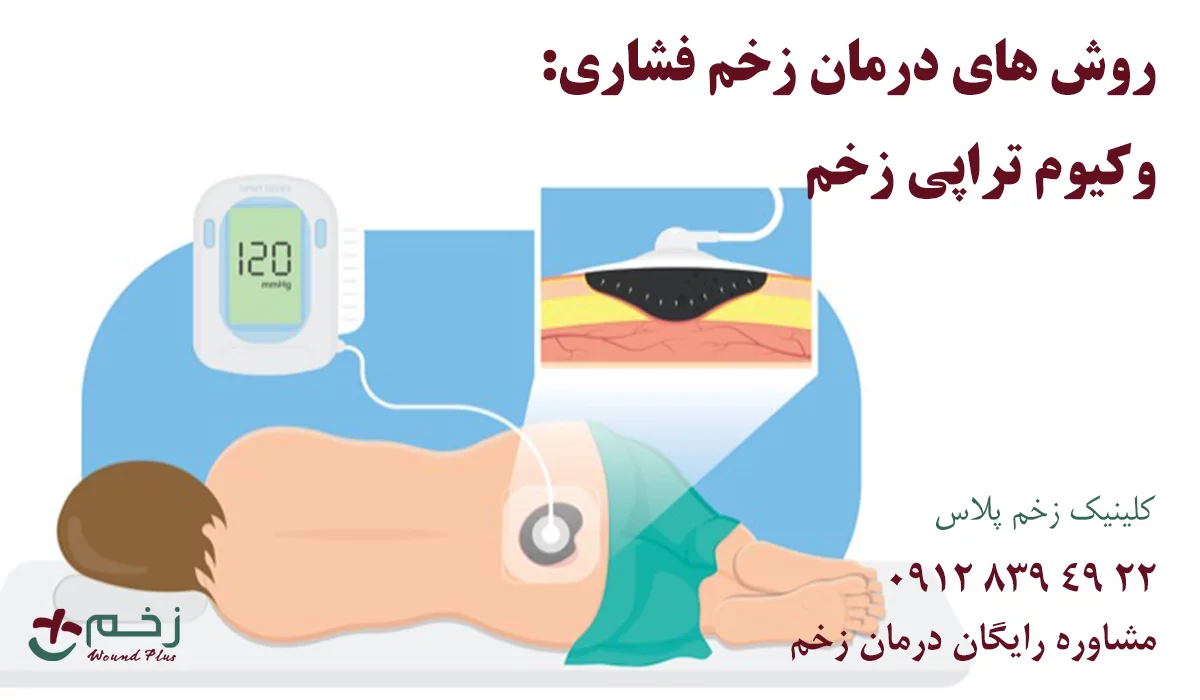 وکیوم تراپی زخم بستر