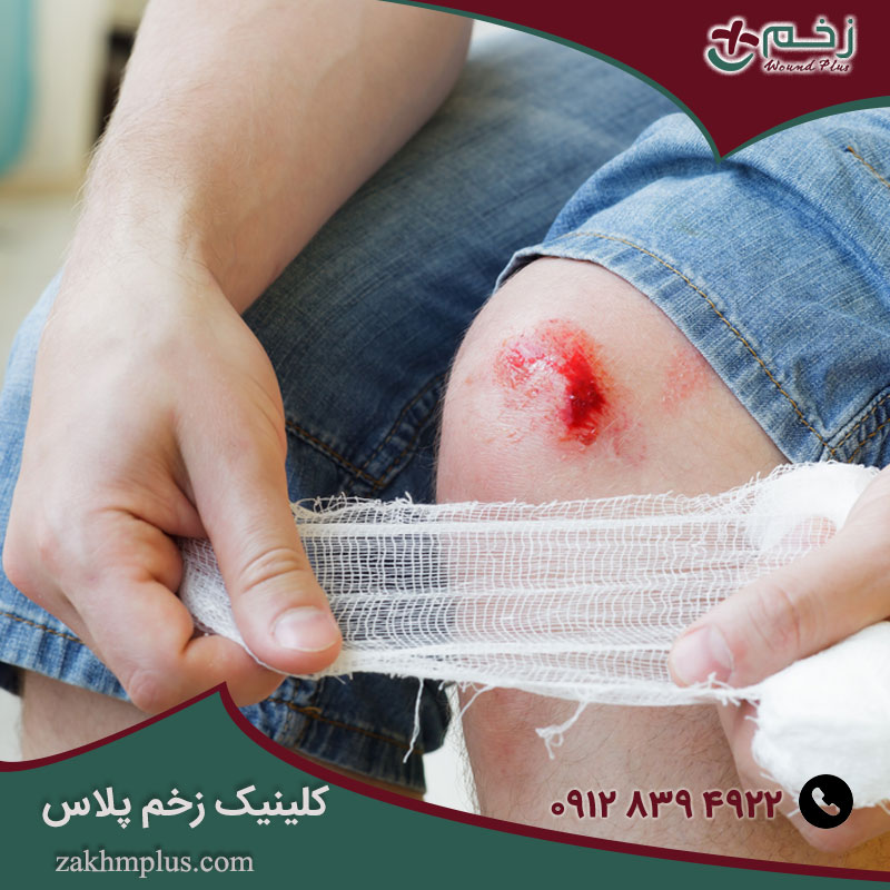 کمک های اولیه در انواع زخم